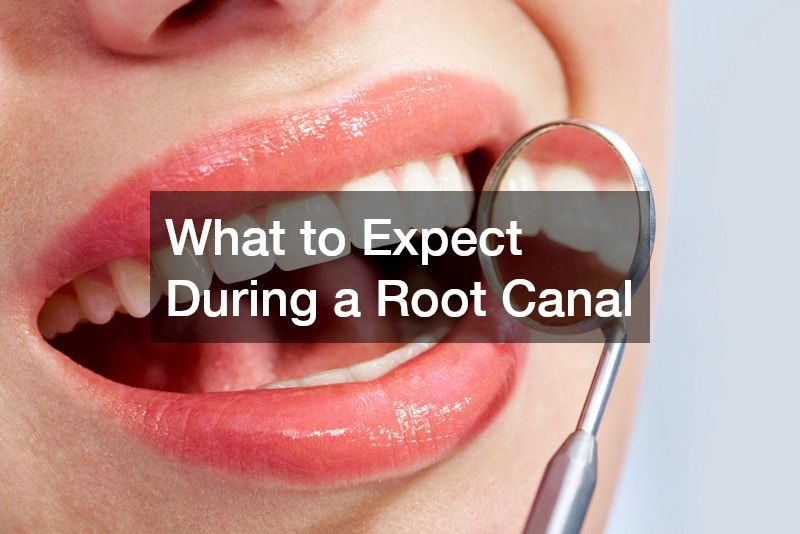 What to Expect During a Root Canal